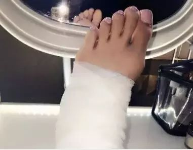 容祖儿因长期穿高跟鞋导致脚变形,一大堆女明星都被它害...