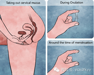 〔备孕攻略〕从小妹妹分泌物预测排卵期