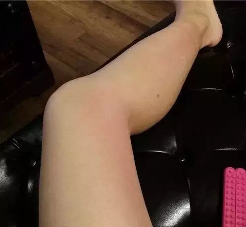 每天刮肝经,无病一身轻29 / 作者:健康小天使 / 帖子ID:167980