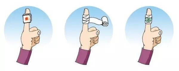 动脉什么压迫止血外伤出血，按哪里止血最有效？_https://www.jmylbn.com_新闻资讯_第7张