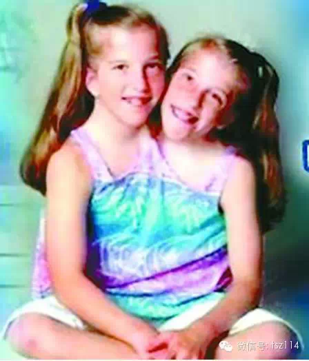 震惊全球！探秘双头美女不为人知的生活