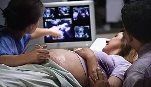 怀孕七个月胎儿彩超及怀孕七个月注意事项!宝妈千万注意啊!