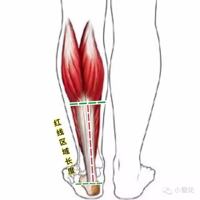测量小腿肌肉最末端至踝关节骨头最下端为跟腱长度