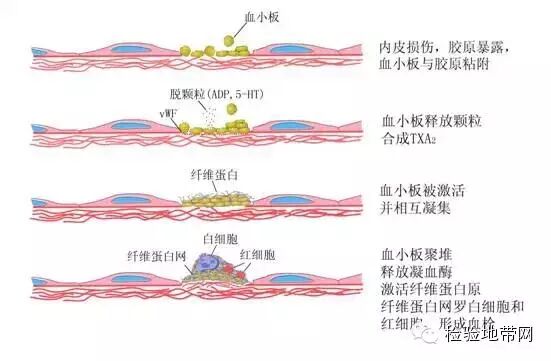 D-二聚体检测结果的影响因素及客观评价