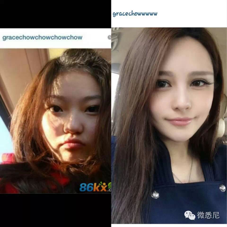 最新版网红整容前后照片对比!又一次看醉了.