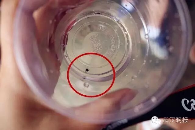 女孩睡梦中觉得脖子痒随手一拍 一觉醒来已毁容