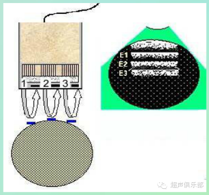 彩超伪像是什么超声伪像 丨US Artifacts_https://www.jmylbn.com_新闻资讯_第1张