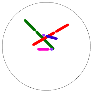 【专家视频解读】☞当怀孕两次都是唐氏胎儿时---刘子建