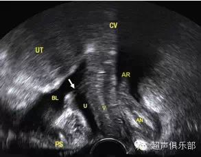 超声在盆底功能障碍性疾病中的应用展望