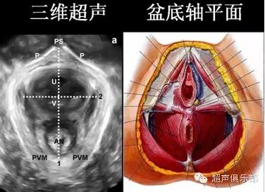 超声在盆底功能障碍性疾病中的应用展望