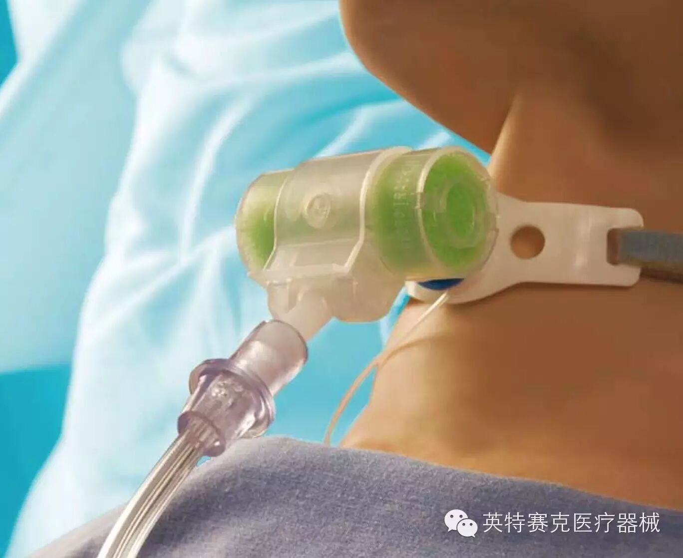 为什么要用湿化器【知识加油站】气道湿化的这些细节_https://www.jmylbn.com_新闻资讯_第1张