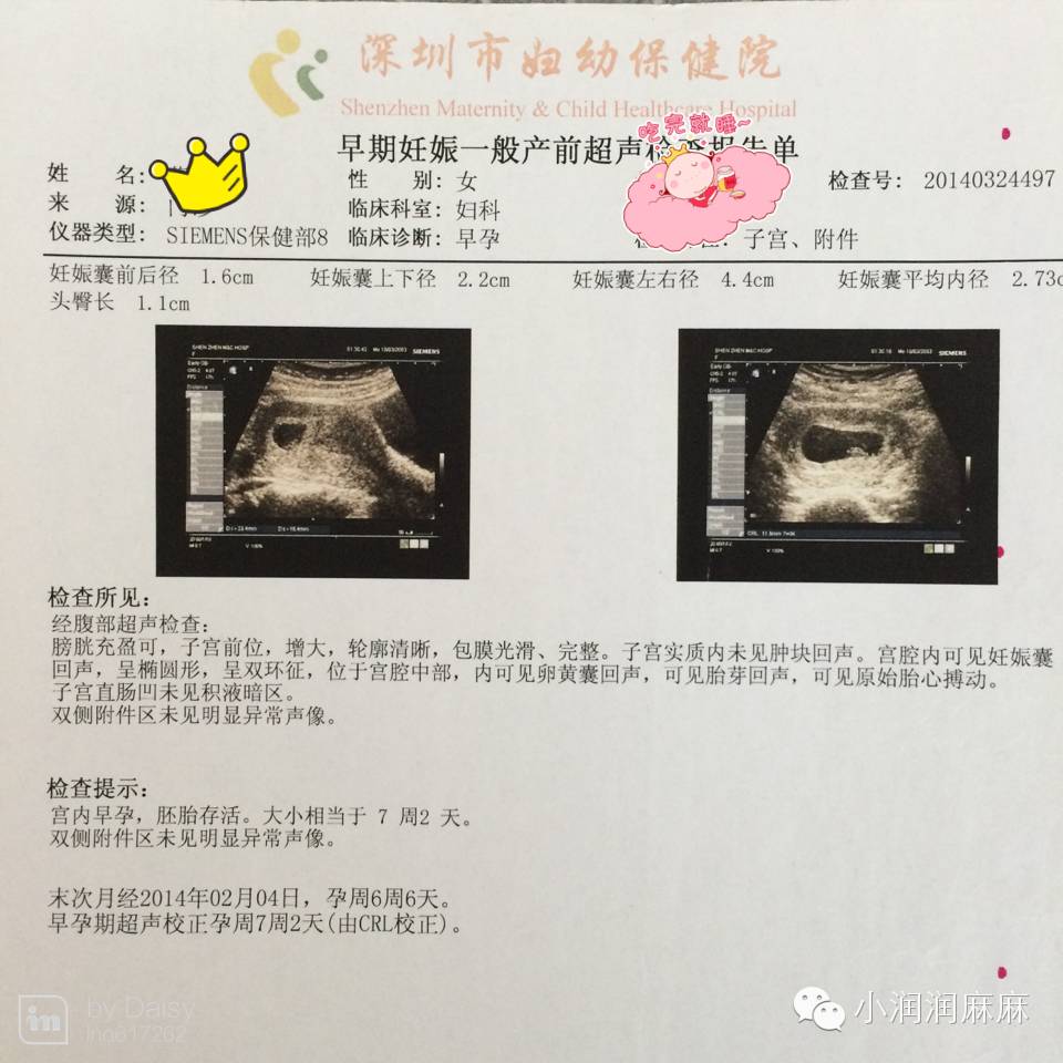 怀孕日记孕期可以任性,但不能任意-怀孕期