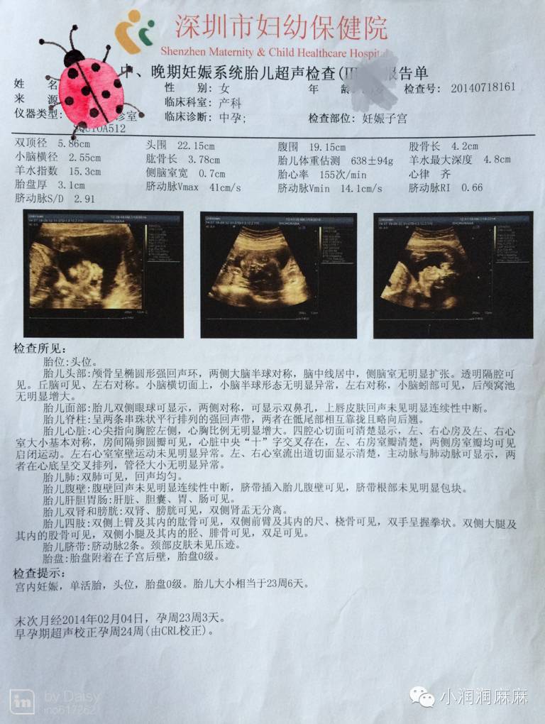 怀孕日记孕期可以任性,但不能任意-怀孕期