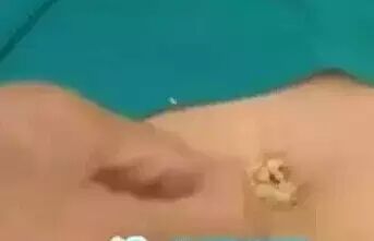把生姜切碎放在肚脐上，没想到第二天......