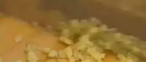 把生姜切碎放在肚脐上，没想到第二天......