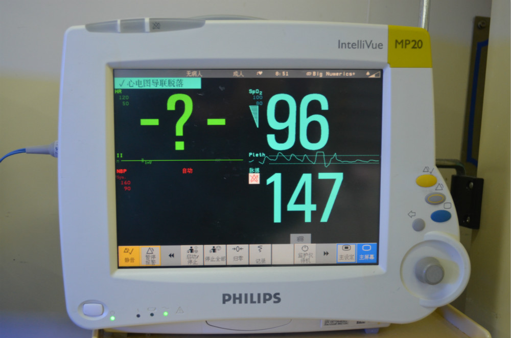 为什么新生儿的监护仪探秘新生儿重症监护病房之——仪器篇_https://www.jmylbn.com_新闻资讯_第2张