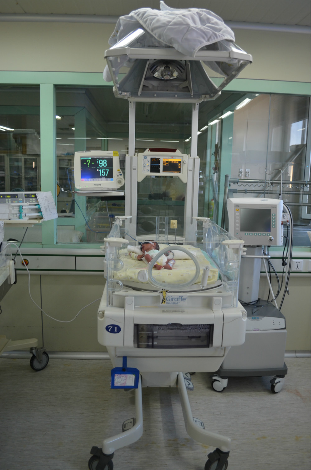 为什么新生儿的监护仪探秘新生儿重症监护病房之——仪器篇_https://www.jmylbn.com_新闻资讯_第7张