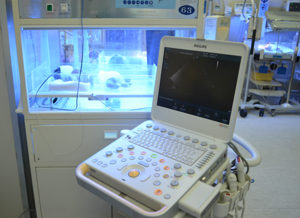 为什么新生儿的监护仪探秘新生儿重症监护病房之——仪器篇_https://www.jmylbn.com_新闻资讯_第9张