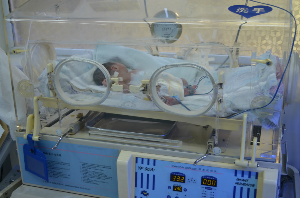 为什么新生儿的监护仪探秘新生儿重症监护病房之——仪器篇_https://www.jmylbn.com_新闻资讯_第4张