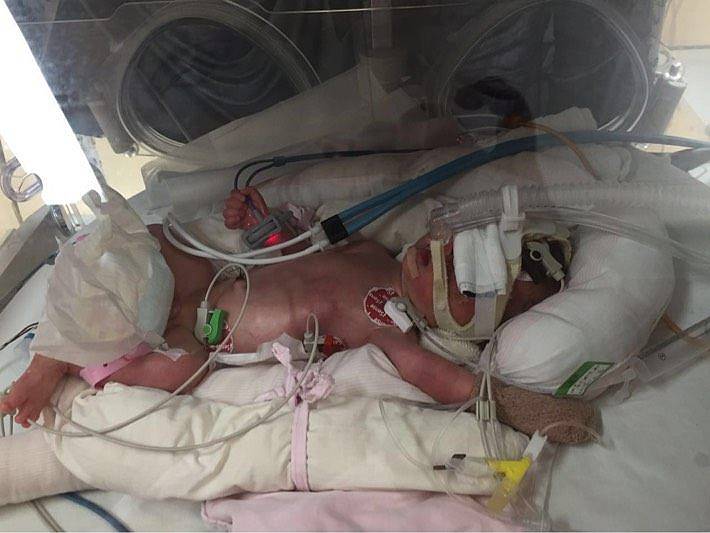 90后合浦美女外嫁山东,怀孕不幸患病急需娘家人救助!-怀孕期