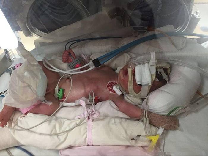 90后合浦美女外嫁山东,怀孕不幸患病急需娘家人救助!-怀孕期