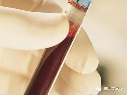 血液标本的颜色