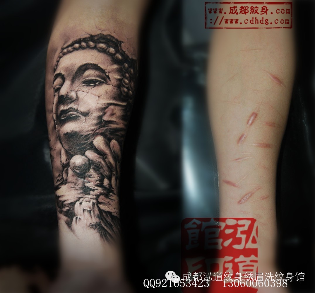 成都纹身绣眉激光洗纹身