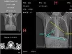 PACS 图像移动端呈现
