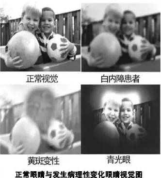 你以为灯光对老人不重要？那你就大错特错！