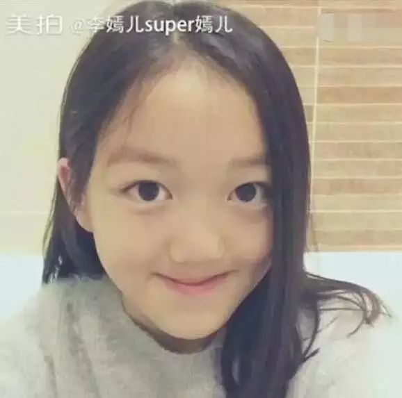 王菲女儿虽有阿缺陷,却依旧长成了最美的样子!