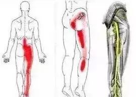 艾灸到底是如何改善人体的? .艾灸养生