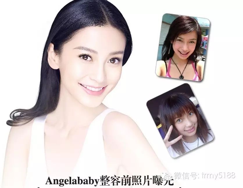 Angelababy整容前照片曝光 丑小鸭也能脱变成白天鹅!