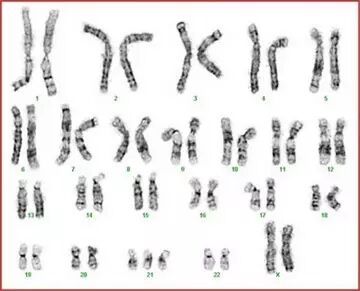 想生二胎?先给身体算一笔帐吧-怀孕期