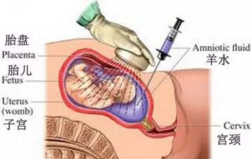 想生二胎?先给身体算一笔帐吧-怀孕期