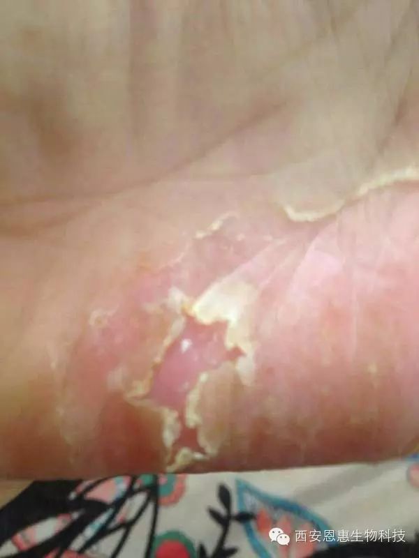 吃了黑豆内膜12毫米_毫米黑豆吃内膜会变厚吗_吃黑豆能增加内膜厚度吗