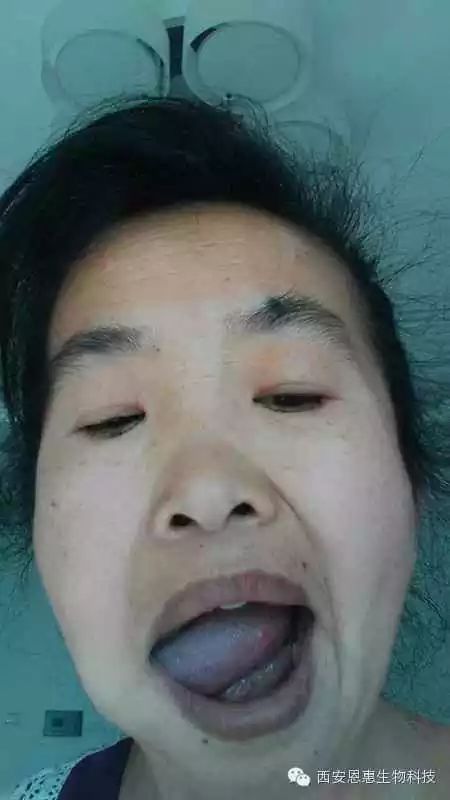 毫米黑豆吃内膜会变厚吗_吃了黑豆内膜12毫米_吃黑豆能增加内膜厚度吗