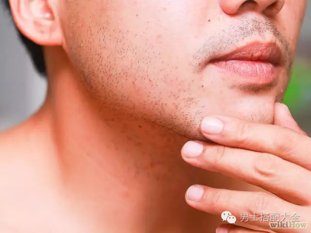 护肤| 男人常见的五种皮肤毛病