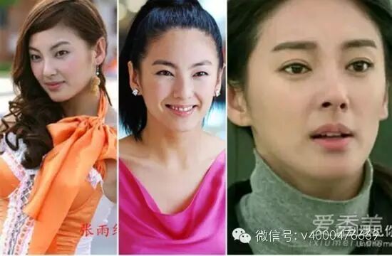 张雨绮 闫妮 刘涛 割双眼皮后才是真女神?