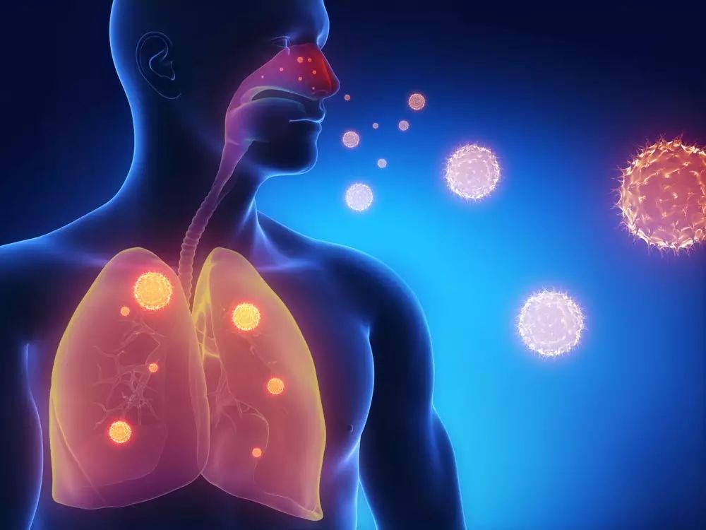 呼吸系统疾病与免疫
