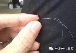 拔白发会拔掉毛囊吗？