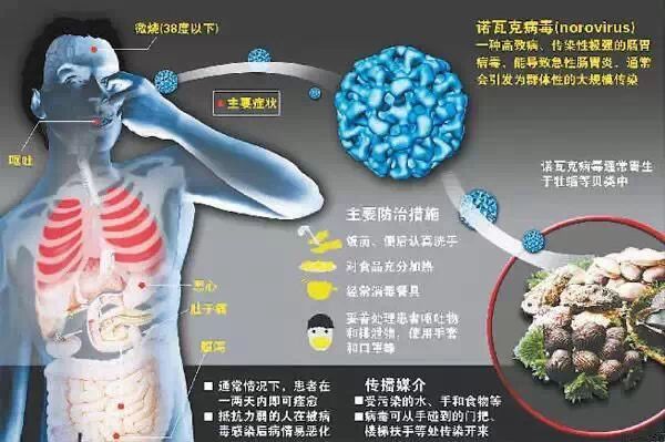 扩散!诺如病毒感染高发季,这些你造么? - 糖果资讯 - 糖果资讯 扩散!诺如病毒感染高发季,这些你造么? - 糖果资讯 - 糖果资讯