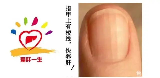 为什么肝癌一发现就是晚期?你“肝”净吗?不护好肝,以后别后悔喽! 为什么肝癌一发现就是晚期?你“肝”净吗?不护好肝,以后别后悔喽!