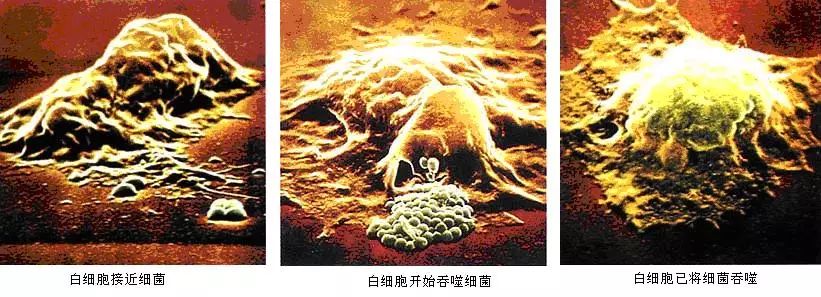 人体的健康卫士——白细胞是怎样排除异己的?