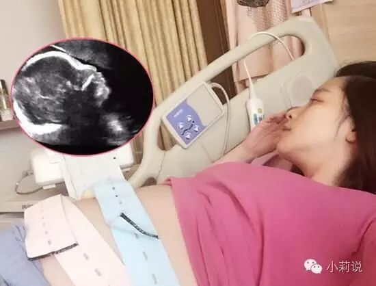 事业关键期怀孕了,孩子要还是不要?-怀孕期