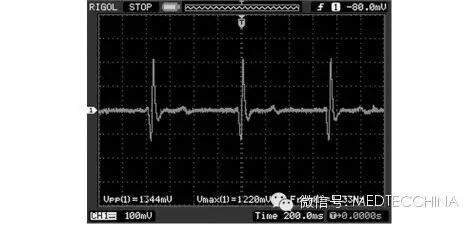 心电图检测仪怎么用技术长文：如何解决心电监护仪小型化——基于微处理器SoC FPGA的心电信号检测系统设计_https://www.jmylbn.com_新闻资讯_第5张
