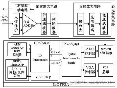 心电图检测仪怎么用技术长文：如何解决心电监护仪小型化——基于微处理器SoC FPGA的心电信号检测系统设计_https://www.jmylbn.com_新闻资讯_第1张