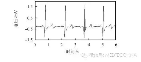 心电图检测仪怎么用技术长文：如何解决心电监护仪小型化——基于微处理器SoC FPGA的心电信号检测系统设计_https://www.jmylbn.com_新闻资讯_第6张