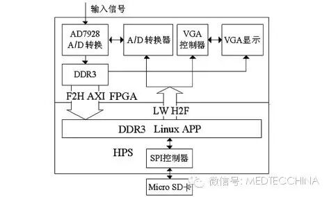 心电图检测仪怎么用技术长文：如何解决心电监护仪小型化——基于微处理器SoC FPGA的心电信号检测系统设计_https://www.jmylbn.com_新闻资讯_第4张