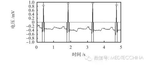 心电图检测仪怎么用技术长文：如何解决心电监护仪小型化——基于微处理器SoC FPGA的心电信号检测系统设计_https://www.jmylbn.com_新闻资讯_第8张