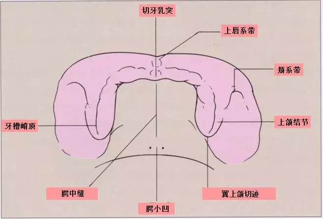 在上颌,上唇系带-切牙乳突-腭小凹,连接其中央的连线;在下颌,下唇系带